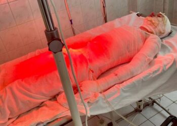 Смертельна ДТП у Рівненській області: 17-річний юнак отримав 60% опіків, поки рятував свою маму