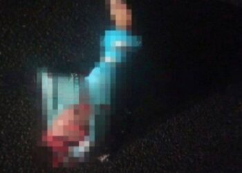 На трасі у Новомосковському районі знайшли людську ногу (ФОТО 18+)