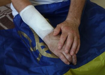 Медики Дніпра розповіли, як рятують поранених унаслідок бойових дій у лікарнях міста