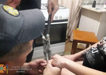 Рятувальники Дніпра допомогли жінці зняти обручку (ФОТО)