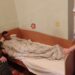 У Кривому Розі рятують родину, яка підірвалася на ворожій міні на Херсонщині