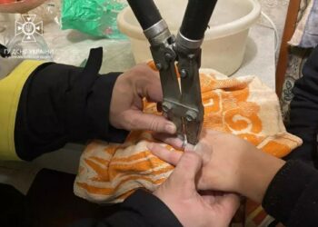 У Дніпрі рятувальники допомогли жінці, на пальці якої застрягла каблучка