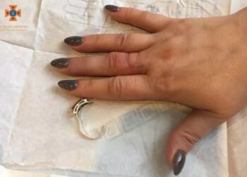 У Дніпрі рятувальники двічі виїжджали на допомогу жінкам, які не могли зняти каблучки