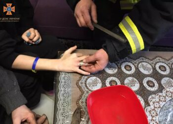 Надзвичайники допомогли юному дніпрянину зняти каблучку з пальця