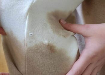 У Дніпрі зграя безпритульних собак напала на дівчинку