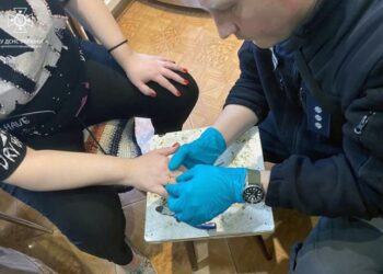 Набряк палець: у Дніпрі рятувальники допомогли жінці зняти обручку