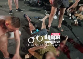 Ледь не лишився руки: у Дніпрі сталася моторошна ДТП за участі скутериста