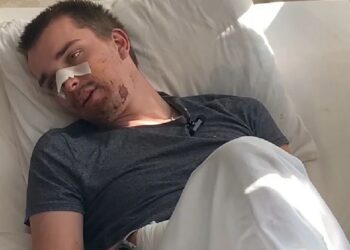 Журналістам вдалося поспілкуватися із пораненим німецьким волонтером, якого рятують у лікарні Дніпра (ВІДЕО)