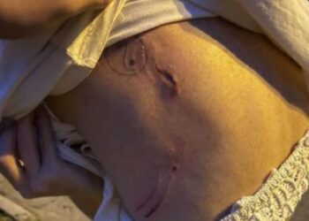 У Дніпрі в парку Шевченка кавказька вівчарка напала на жінку