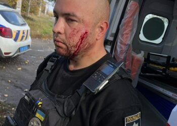 У Павлограді чоловік поранив ножем себе та поліцейського: правоохоронцям довелося стріляти (ВІДЕО 18+)