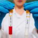 На території області встановлено штами Omicron SARS-CoV-2, вірусів грипу типу А та парагрипу