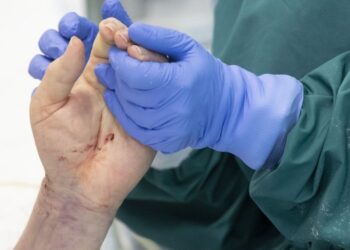 Стало відомо про стан поранених через ракетну атаку на Дніпро