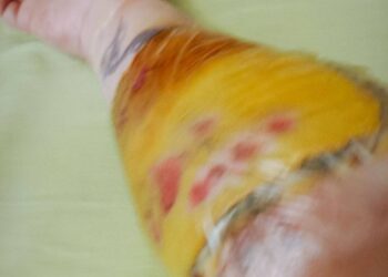 У Дніпрі чоловік порізав собі вени у ТЦК і втік
